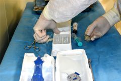 Врачи Чувашии впервые провели транскатетерную имплантацию аортального клапана сердца